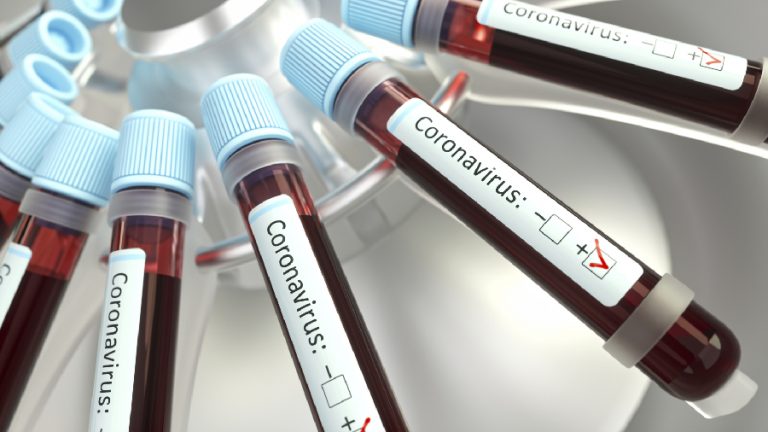 Coronavirus tubos web