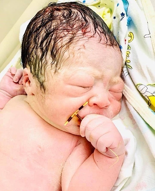 Bebé anticonceptivo mano