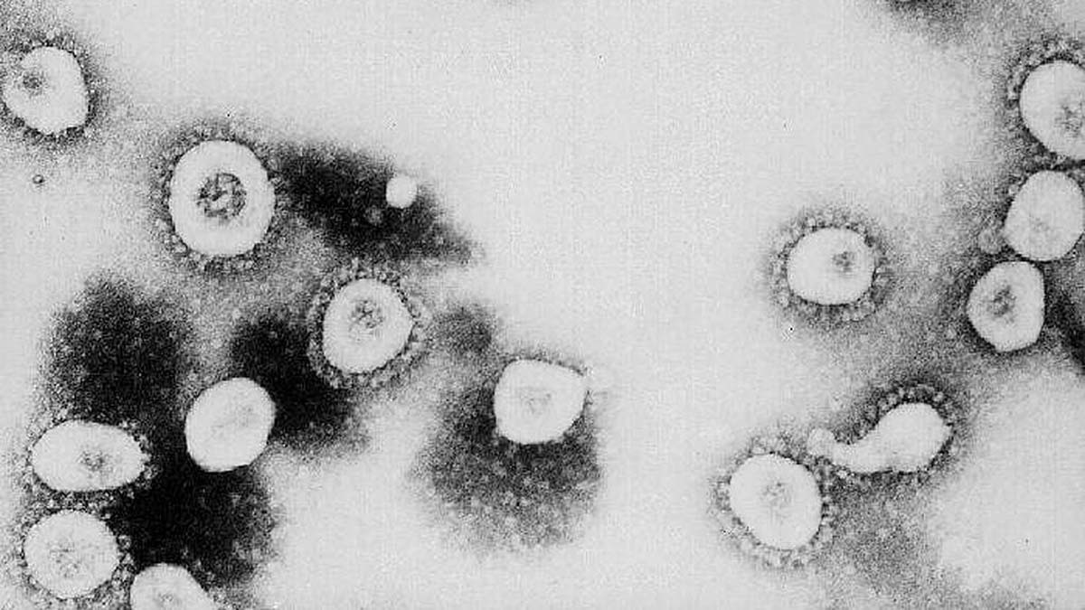 Coronavirus P1 Covid-19