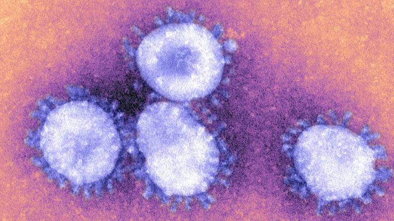 Coronavirus P1 Covid-19