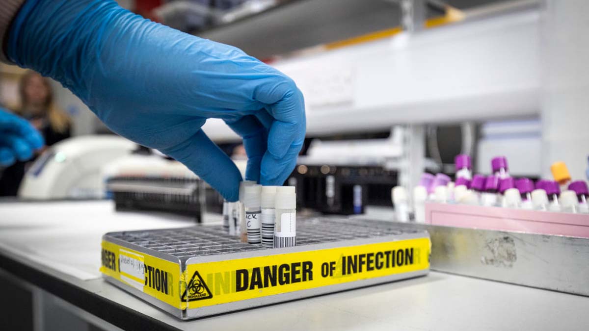 Coronavirus P1 Covid-19