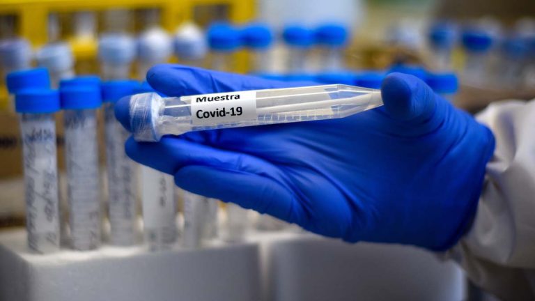 Muestras De Covid-19 Realizada En Hospital