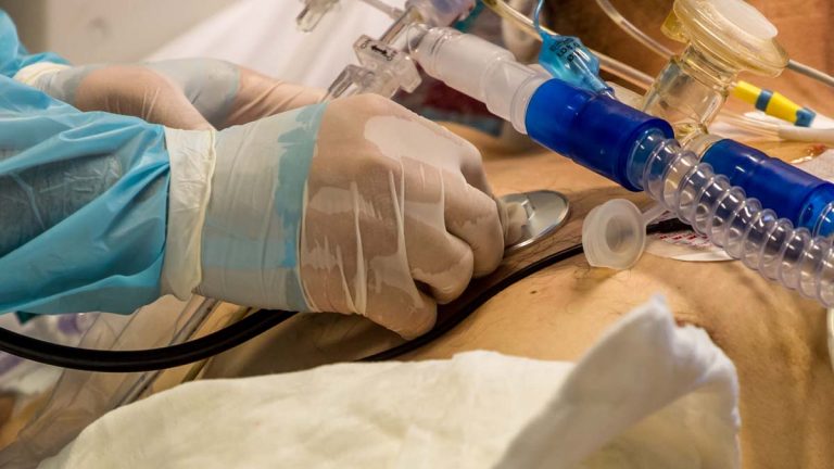 Covid-19 coronavirus