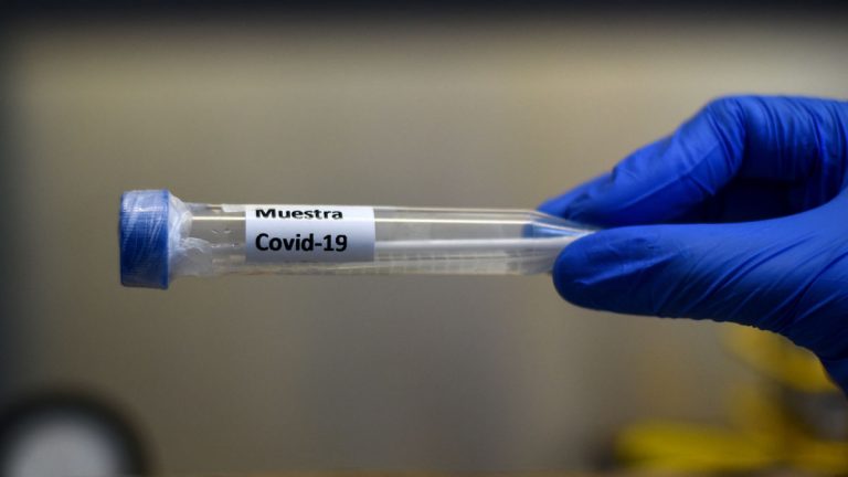 Covid-19 coronavirus