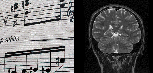 Música En El Cerebro
