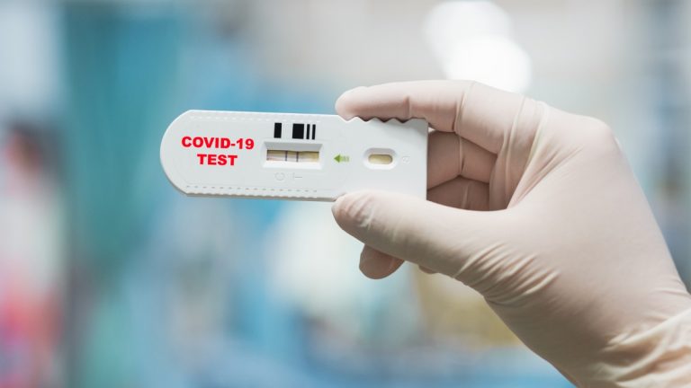 Covid 19 SARS CoV 2 Coronavirus 2