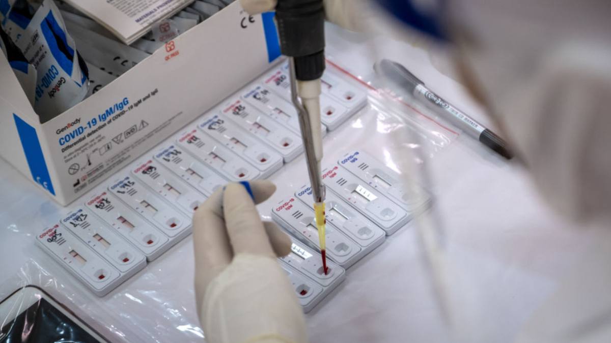 Prueba Covid 19 Coronavirus