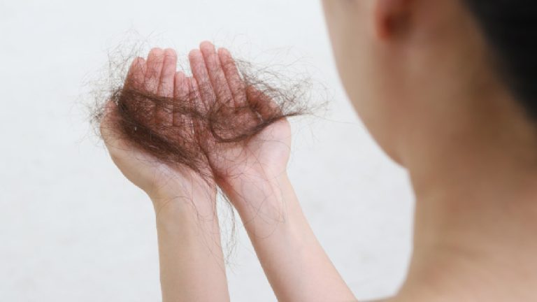 Cura De La Alopecia