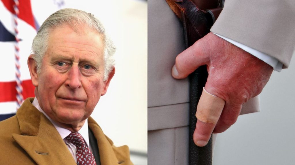 Rey Carlos III Manos