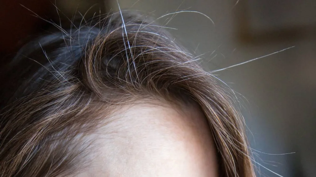 Que Significa No Tenirse Las Canas