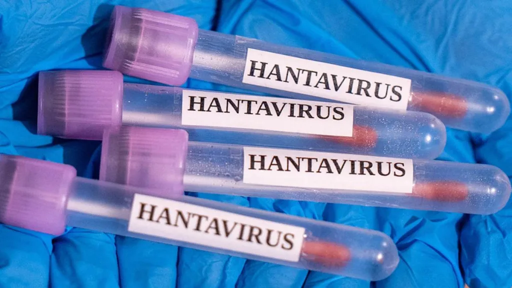 Hantavirus 3