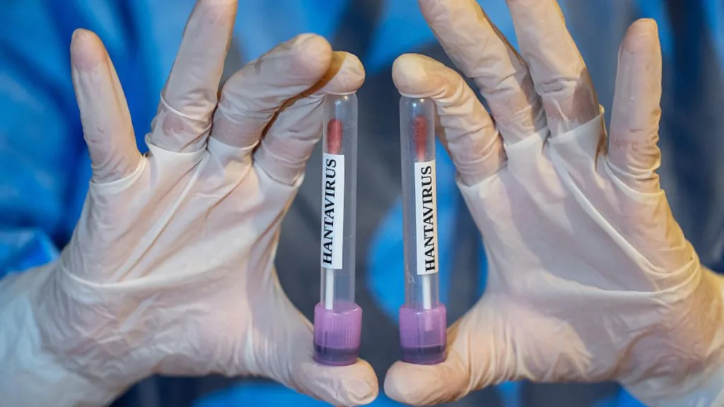 Hantavirus 4