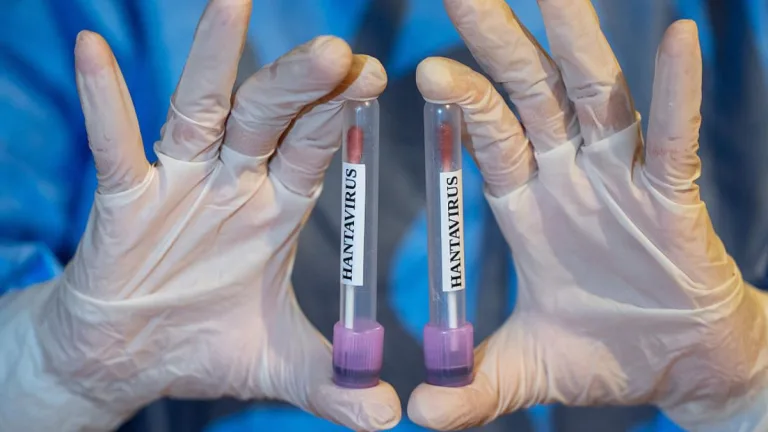 Hantavirus 4