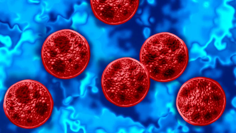 Ciclosporiasis
